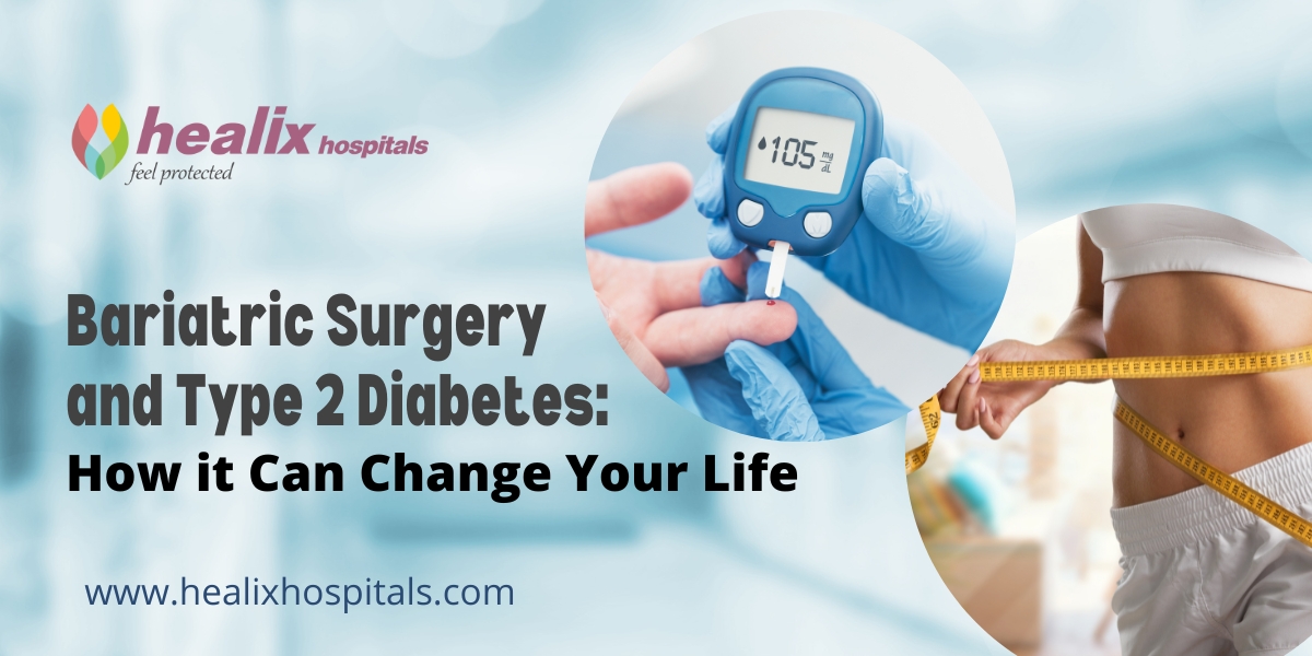 Bariatric Surgery and Type 2 Diabetes: How it Can Change Your Life